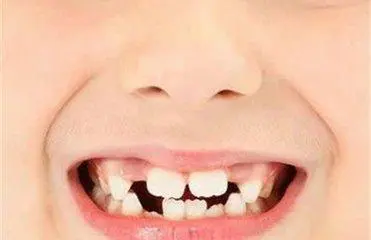 西宁牙齿种植
